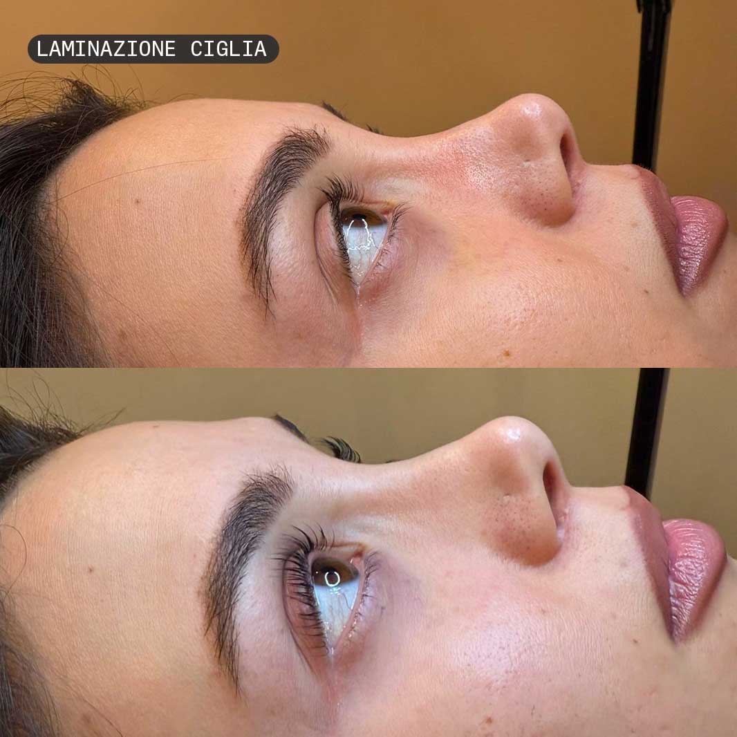 laminazione-ciglia3