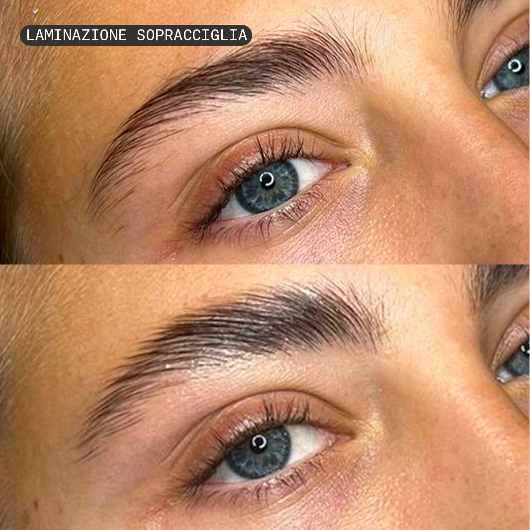 laminazione-sopracciglia1